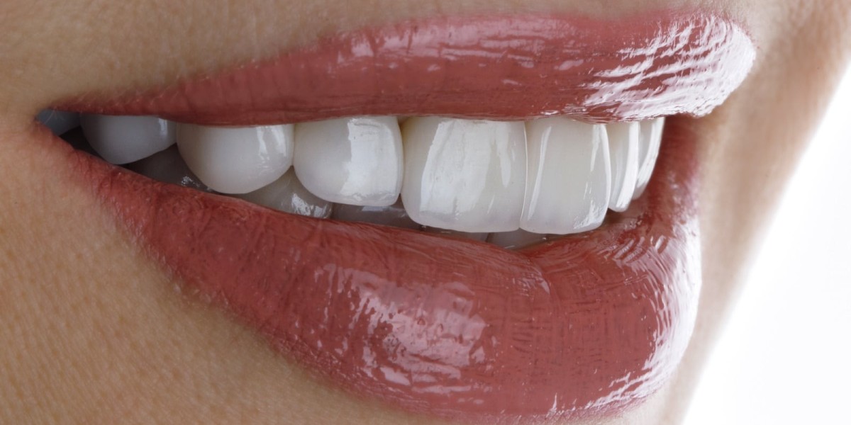 Veneers in Dubai for Gapped Teeth