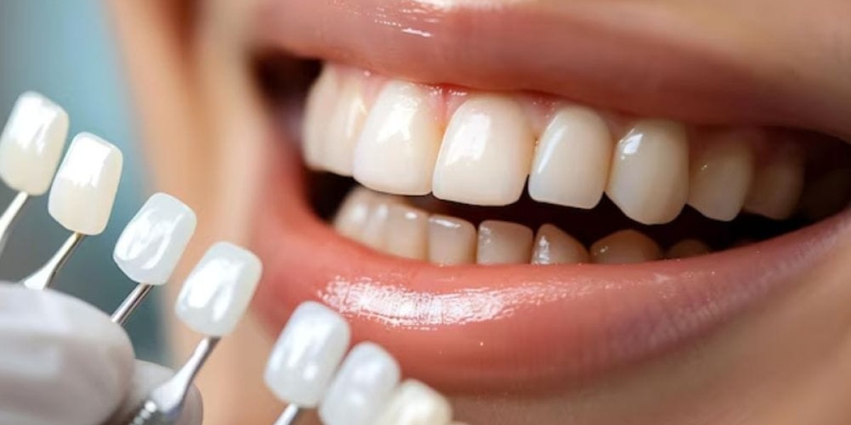 Building a Lifetime of Healthy Smiles with a Trusted Dentist Newport Beach