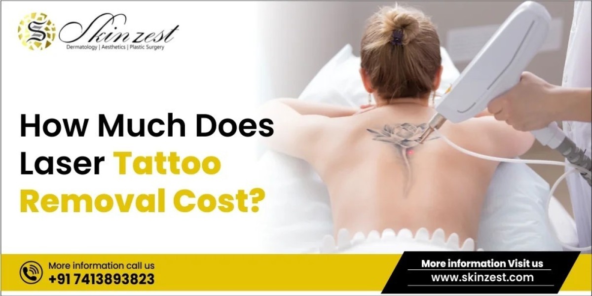 Laser Hair Removal Gurgaon: How Much Does Laser Tattoo Removal Cost?